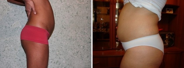 10 Weeks Pregnant With Twins And No Belly Diet
