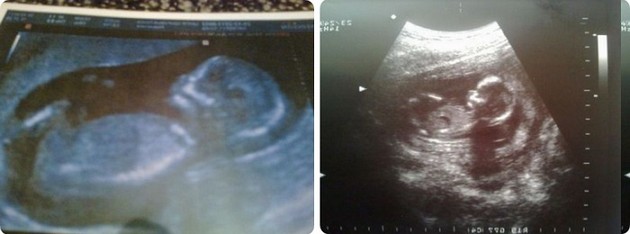 14 Weeks Pregnant 2