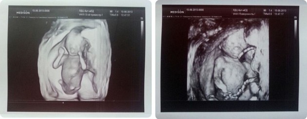 16 Weeks Pregnant 3