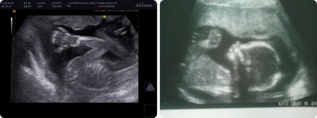 19 Weeks Pregnant 3