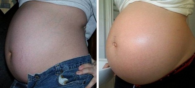 35 Weeks Pregnant 2
