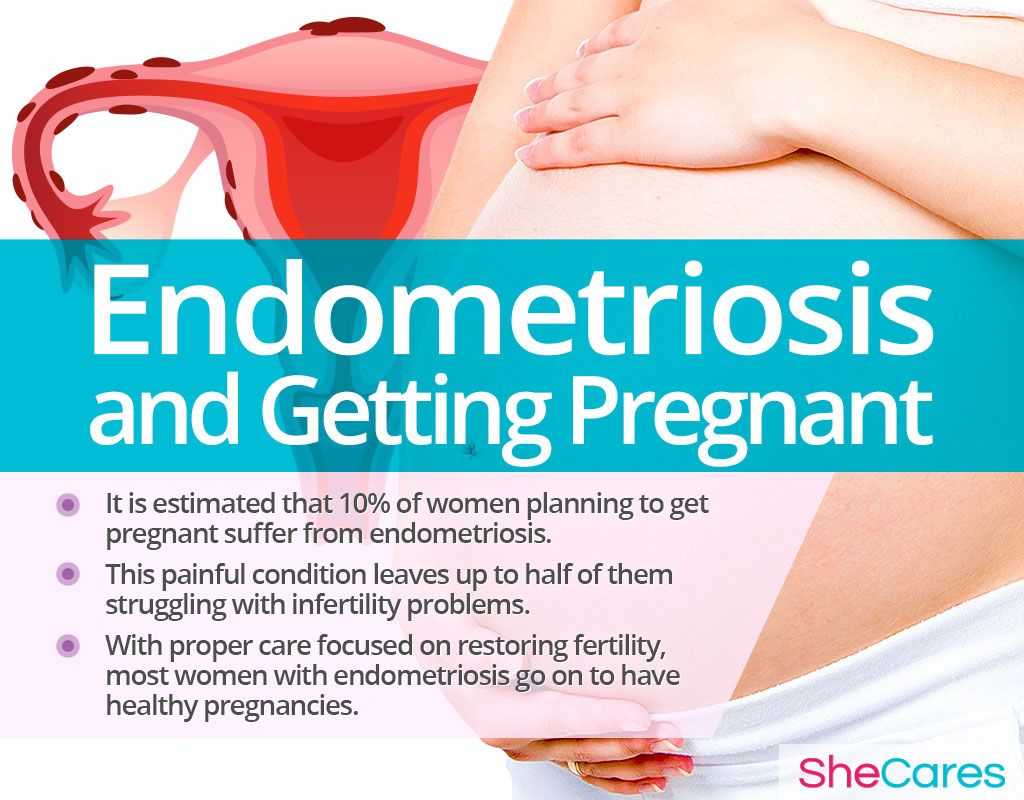Endometriosis And Pregnancy 1