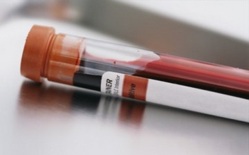 How Early Can A Blood Test Detect Pregnancy