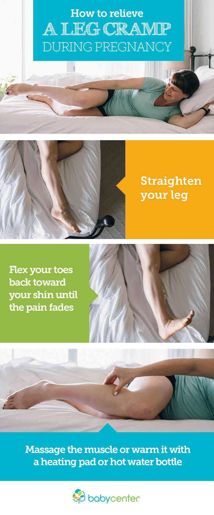Leg Pain During Pregnancy 1