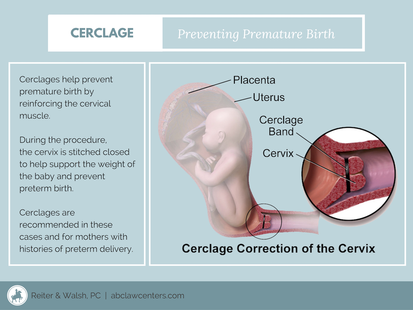 Cervix During Pregnancy 1
