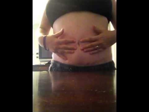 Pregnancy After Tummy Tuck 1