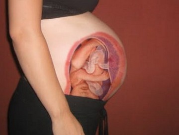 Tilted Uterus During Pregnancy