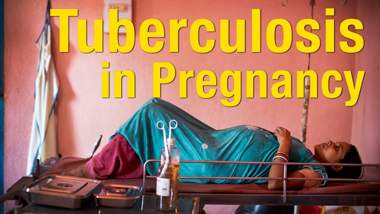 Tuberculosis In Pregnancy 1
