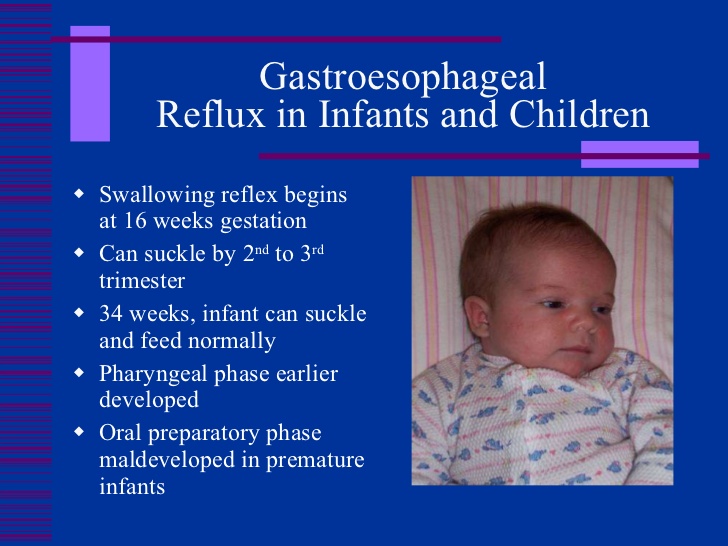 Acid Reflux And GERD In Babies
