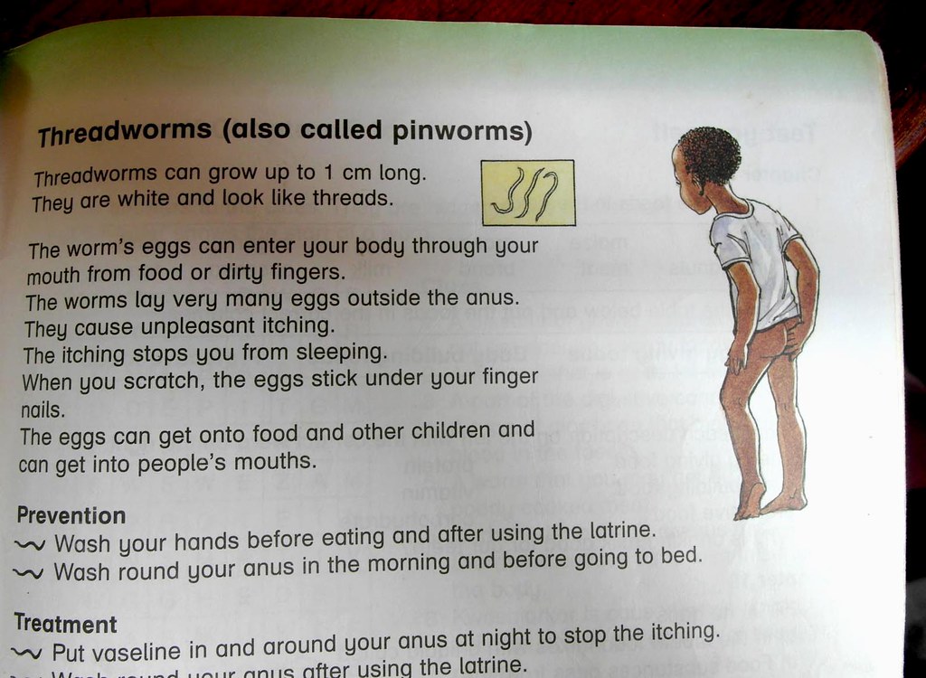 Pinworms In Children 3