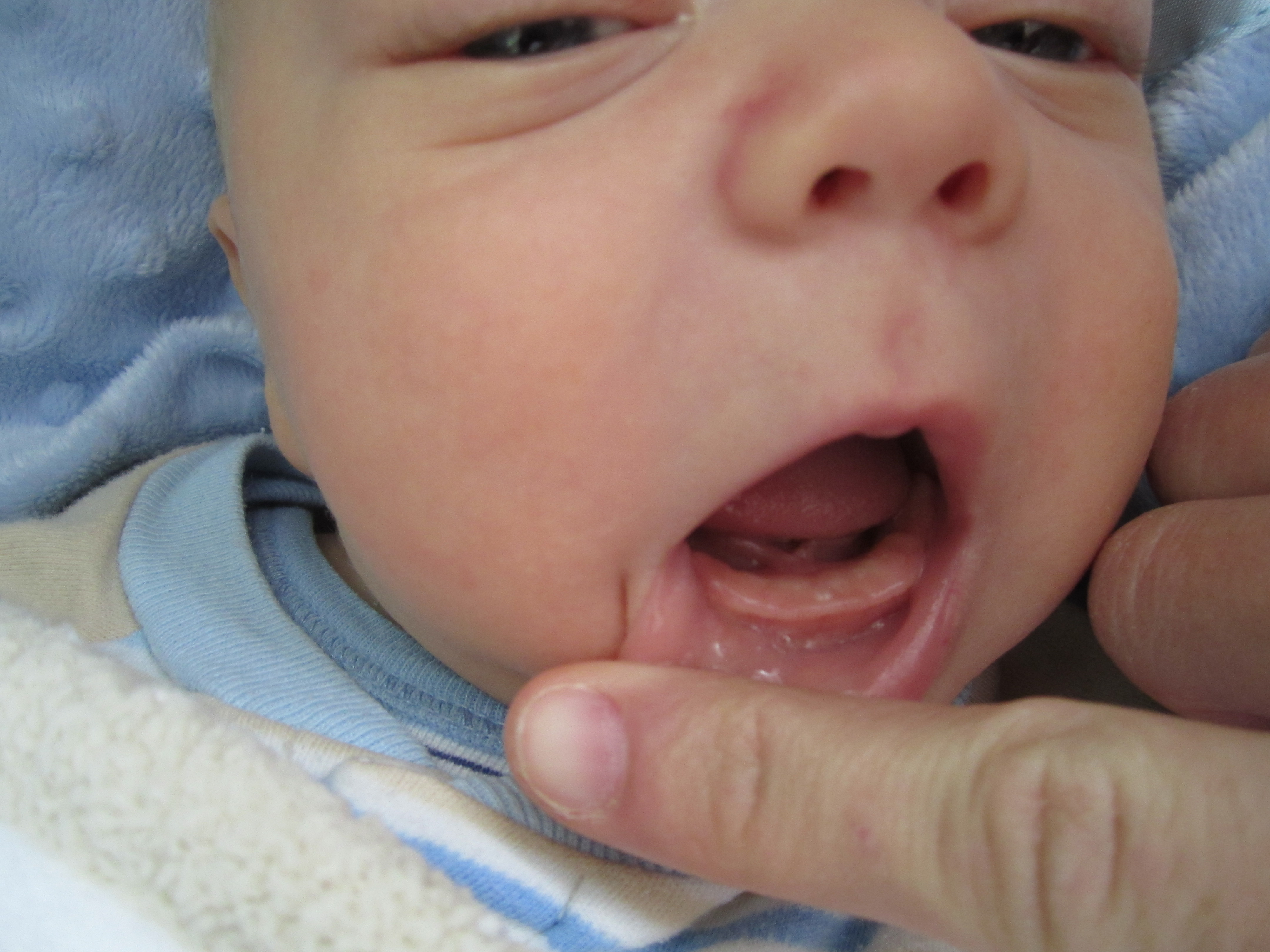 Teething In Baby