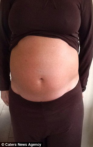 Swelling After Pregnancy 2