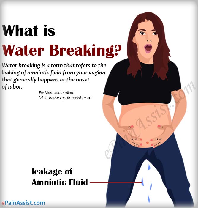 Water Breaking During Pregnancy 2