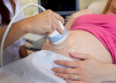 Doppler Ultrasound During Pregnancy
