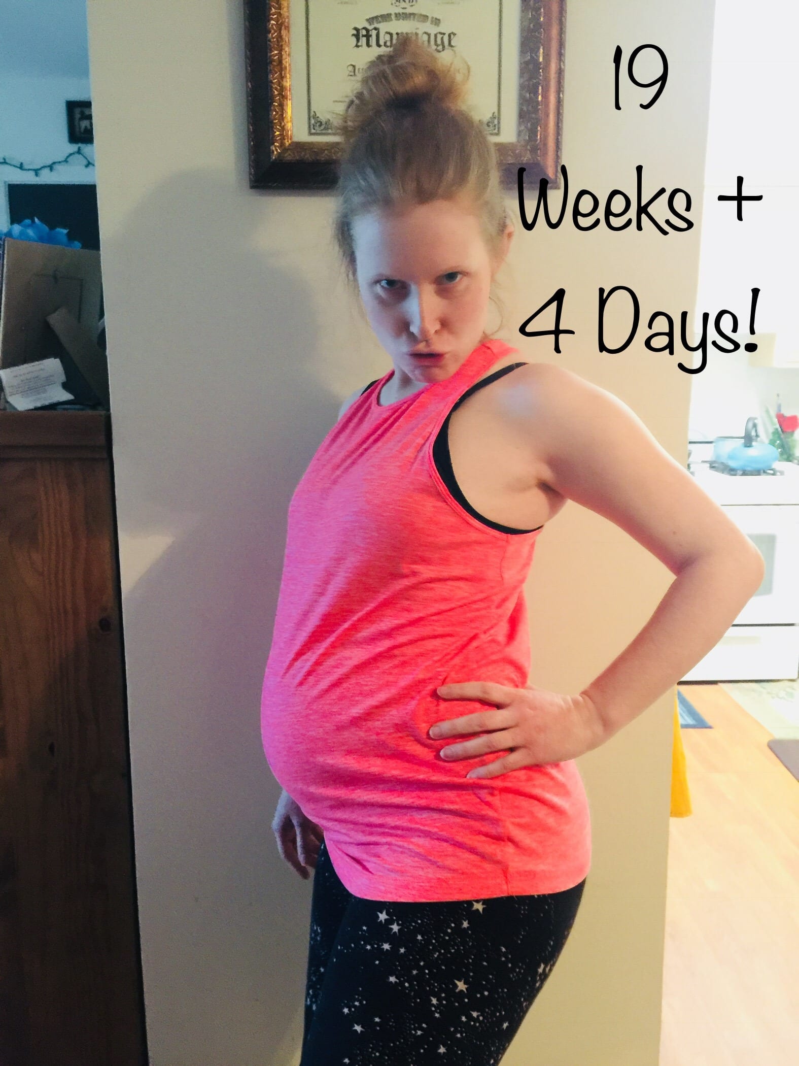 Twin Pregnancy at 19 Weeks