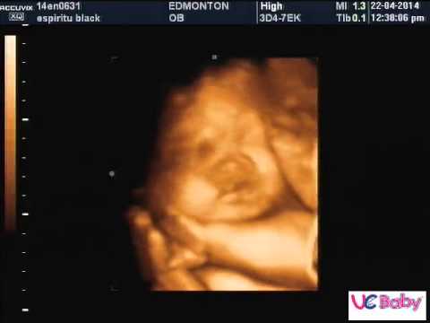 31 Week Ultrasound Boy