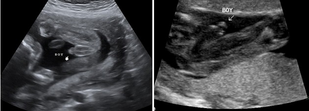 ultrasound at 8 months pregnant