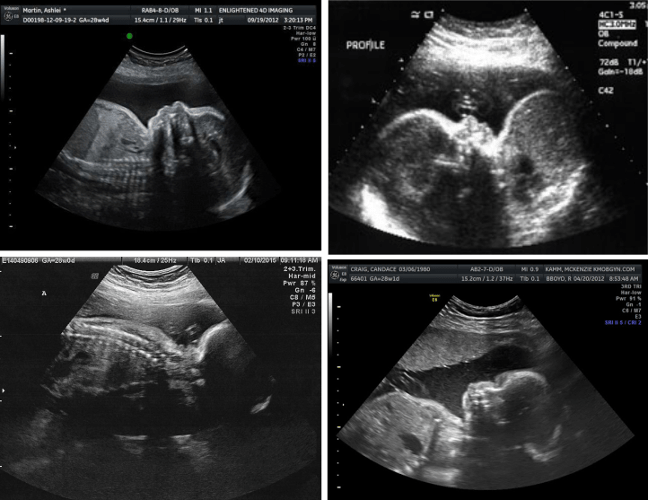 ultrasound at 7 months pregnant