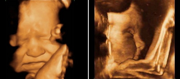 Ultrasound at 39 Weeks Pregnant