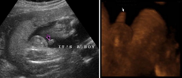 28 Week Ultrasound Boy