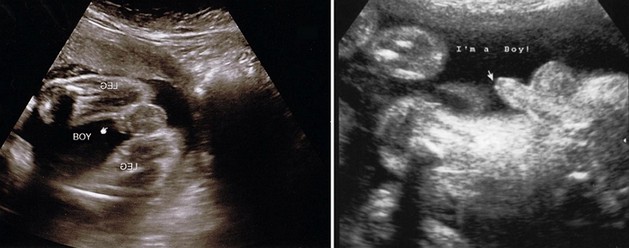 27 Week Ultrasound Boy