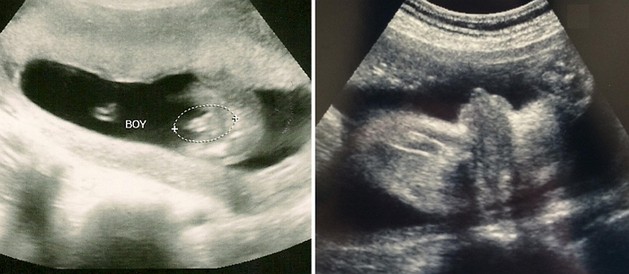 29 Week Ultrasound Boy