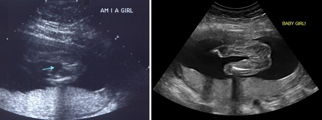 27 Week Ultrasound Girl
