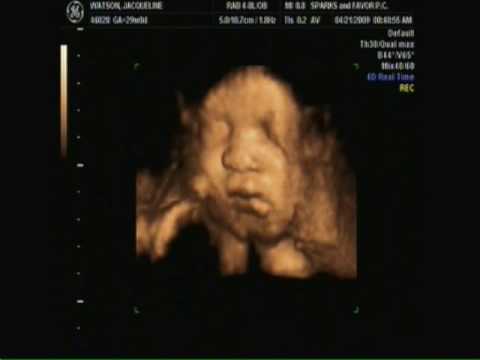 7 Months Ultrasound Girl