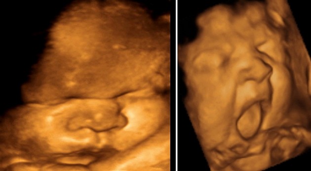 Ultrasound at 38 Weeks Pregnant