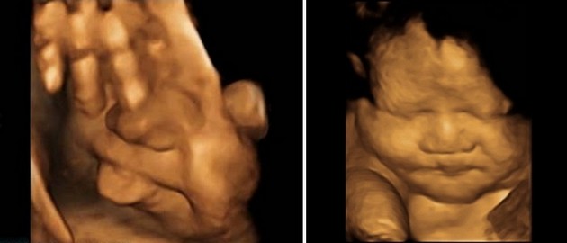 Ultrasound at 37 Weeks Pregnant