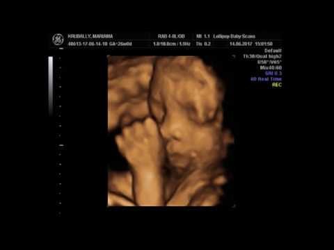 26 Week Ultrasound Boy