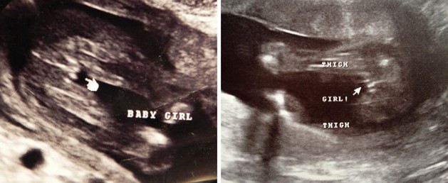 19 Week Ultrasound Girl